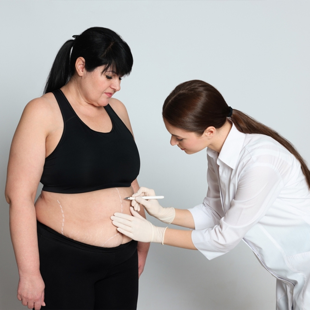 Types of obesity treatments and surgeries