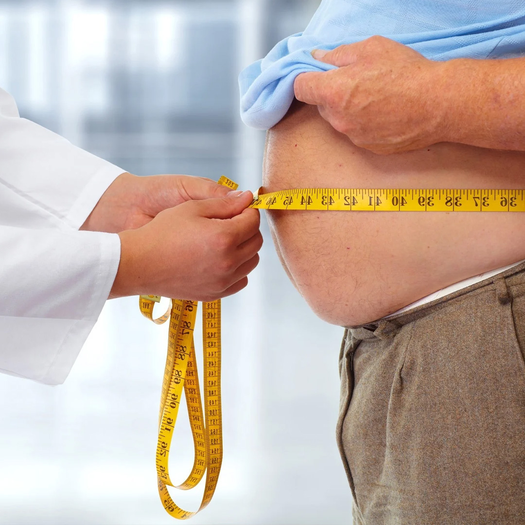 Who is eligible for Obesity surgery?